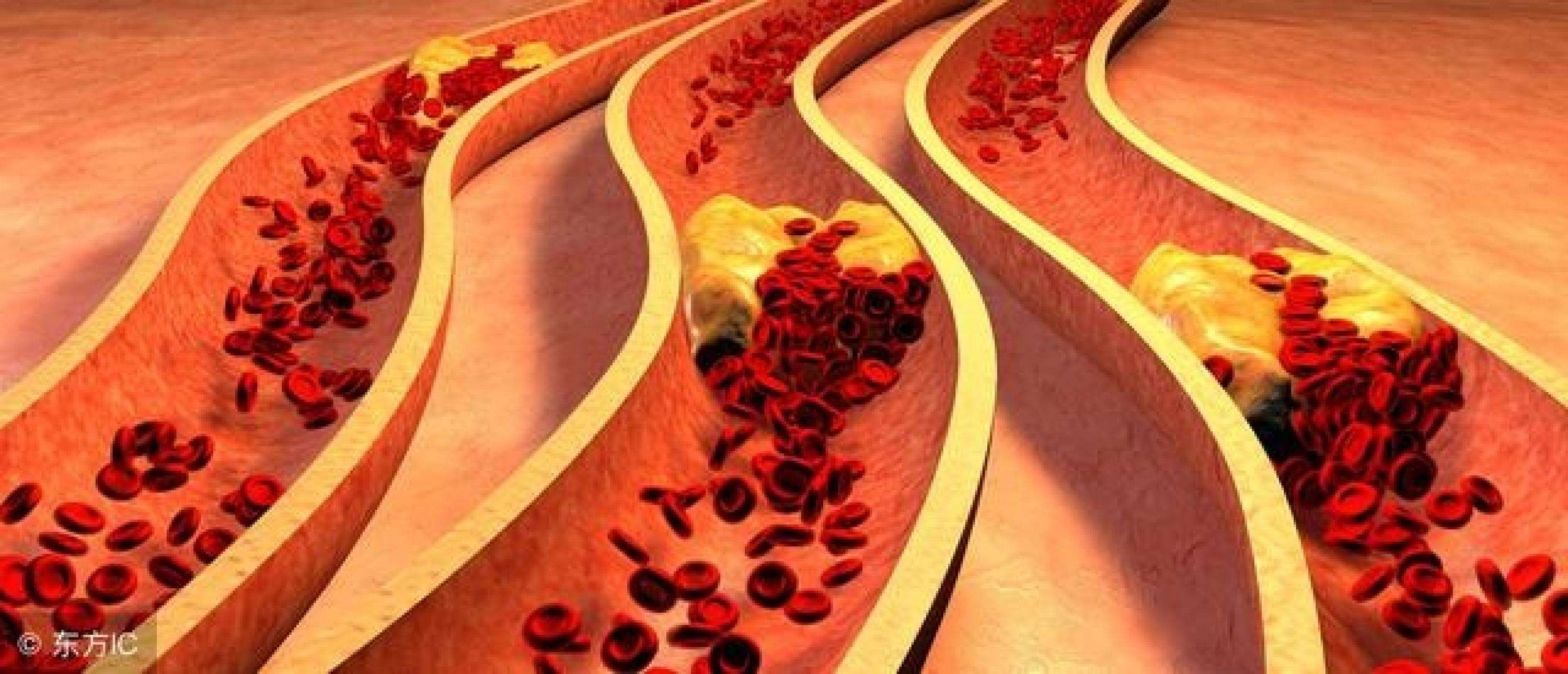 短裤穿久有什么危害,短裤穿太高有哪些症状