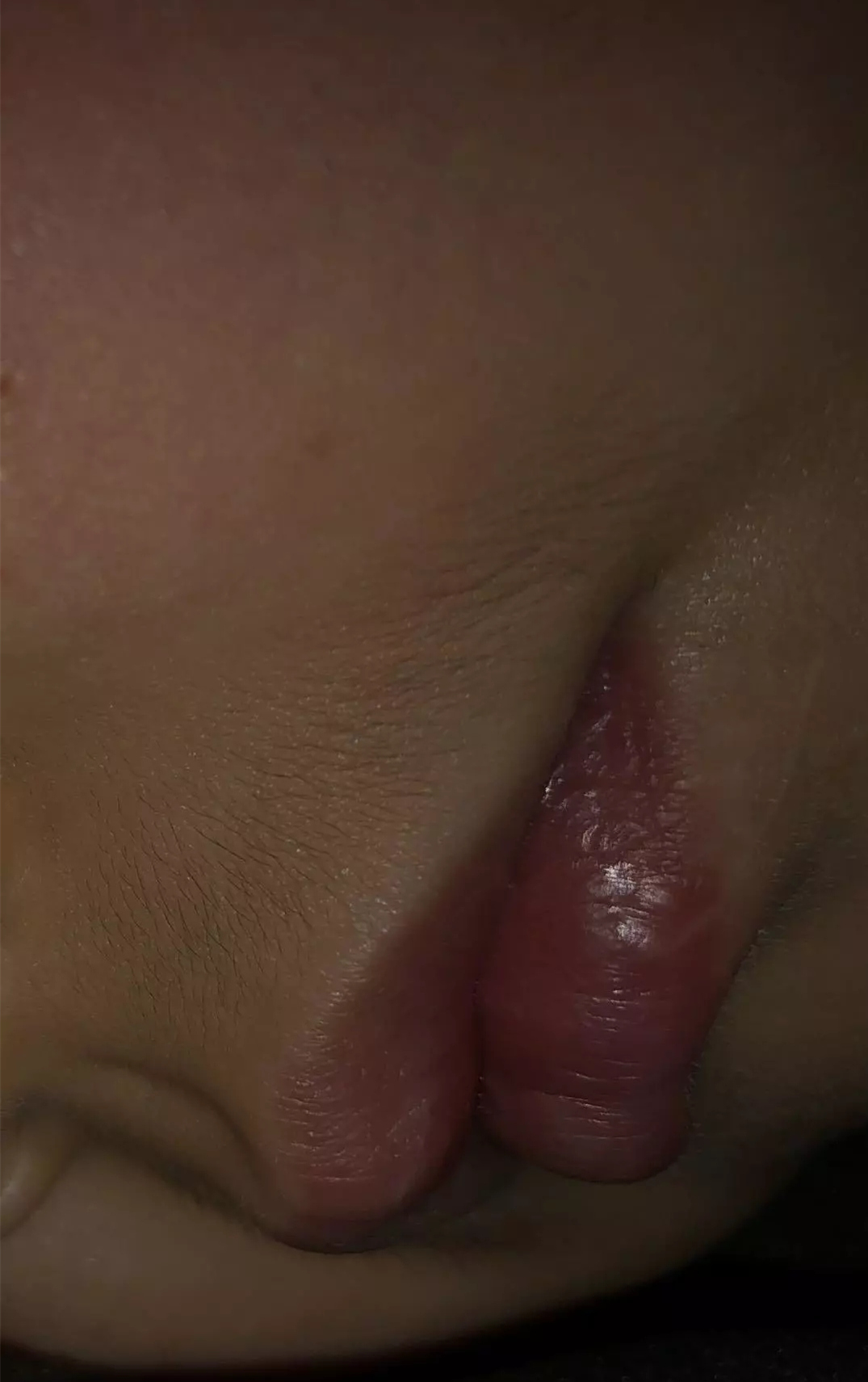 小朋友吃了长胡子的食物,什么样的食物小孩吃了容易长虫