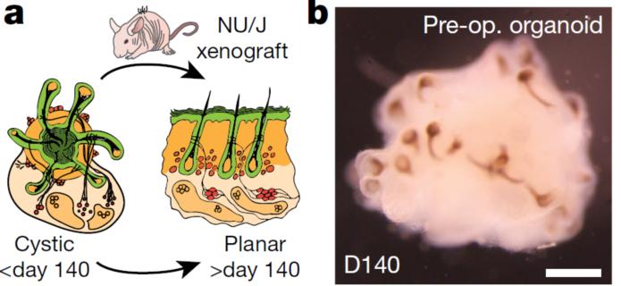 脱发人群超25亿解救头发从它开始,脱发最新研究成果