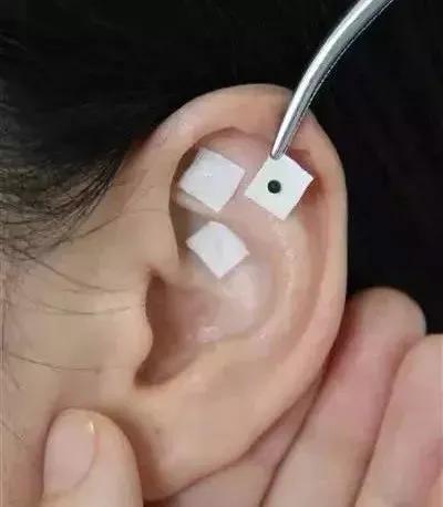 庞医生妇科,庞医生说中医治妇科炎症