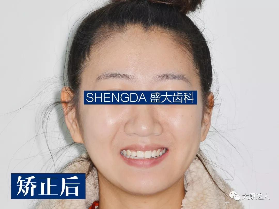 山西“爱马仕”级别齿科医院！get明星同款笑容