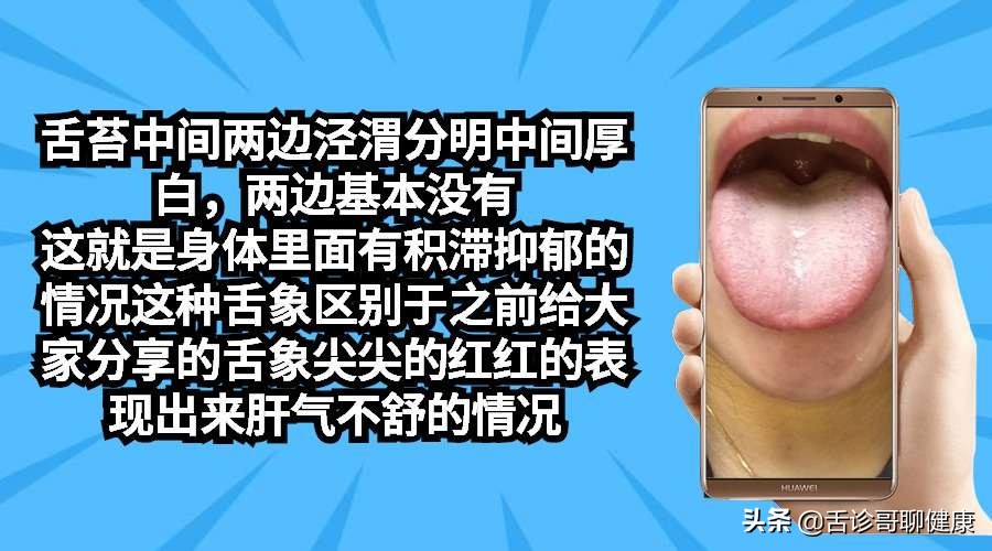 抖音舌诊哥,舌诊歌舌象分析和感悟