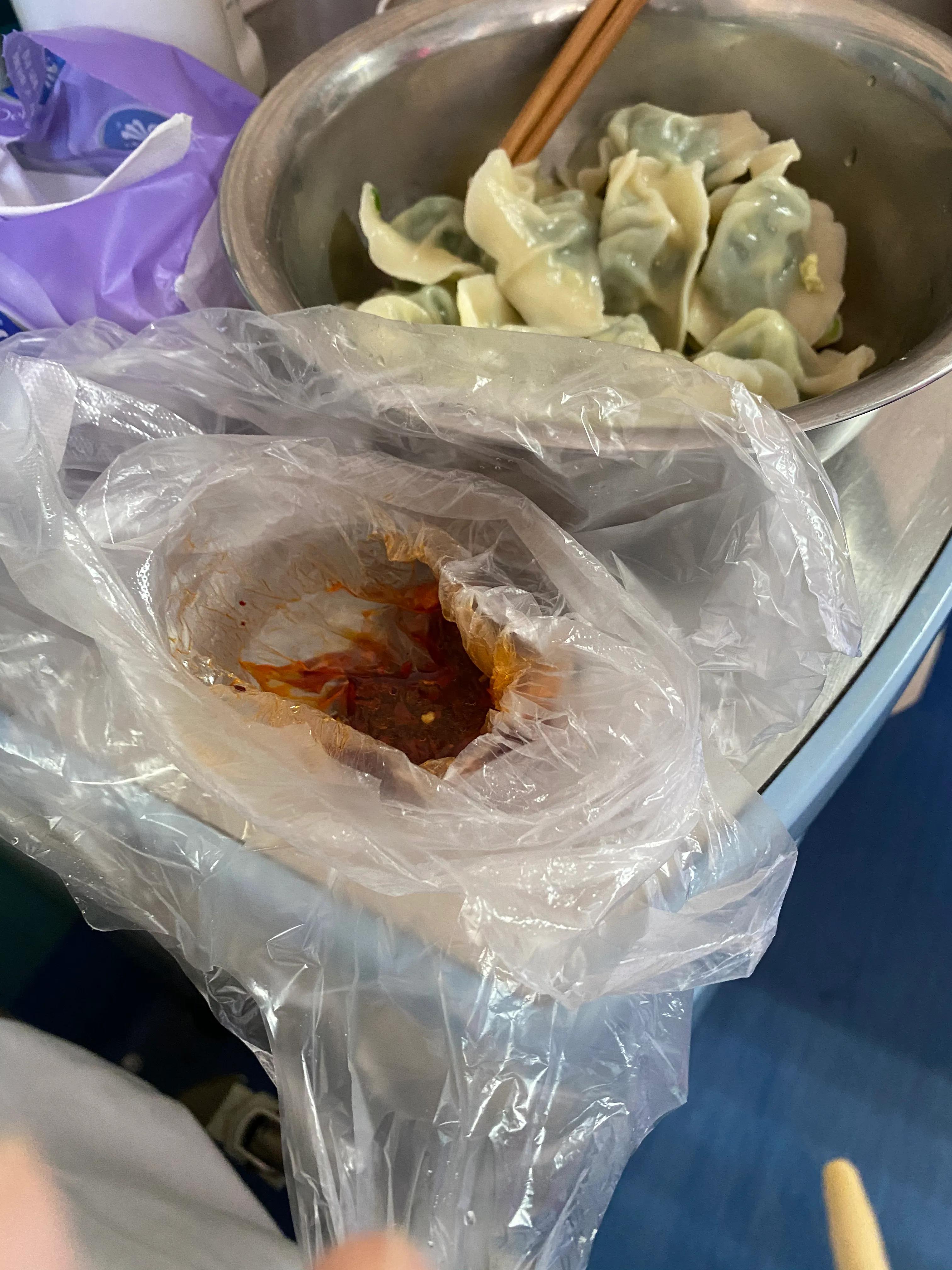 白血病住院后续,白血病第一期28天