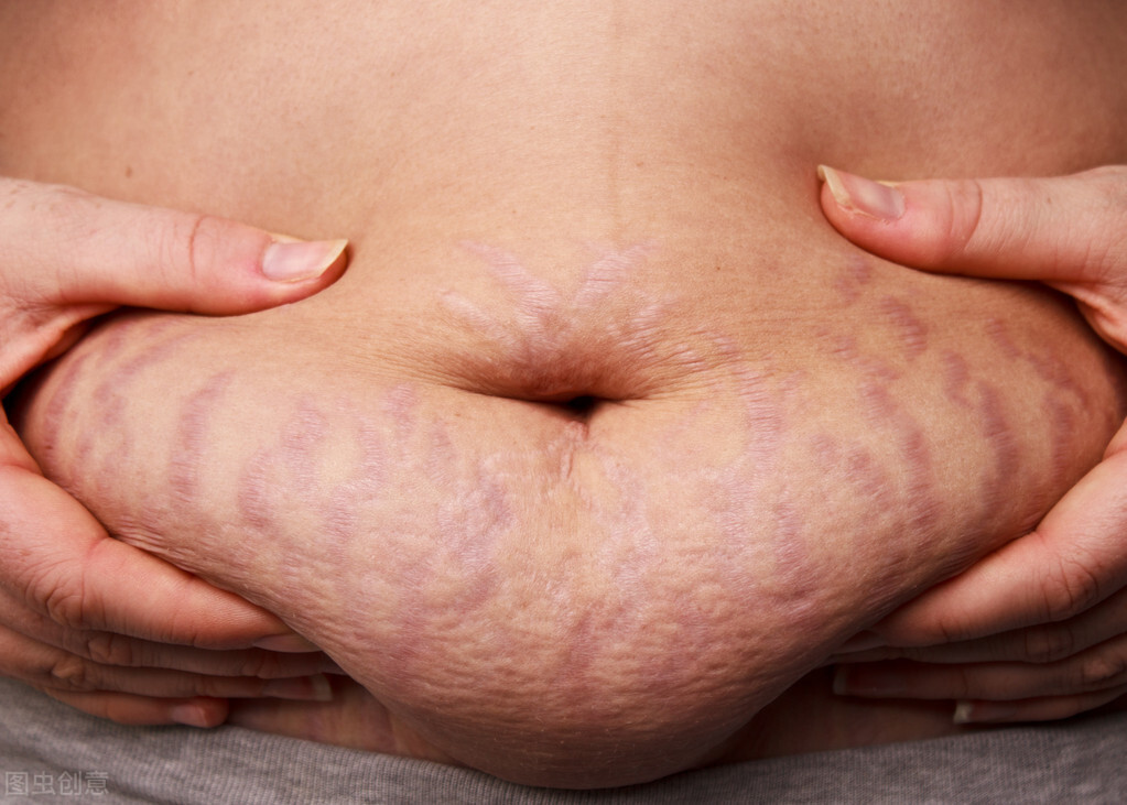 幸福头上一把刀？孕期无痕愿望，十月天使帮你实现