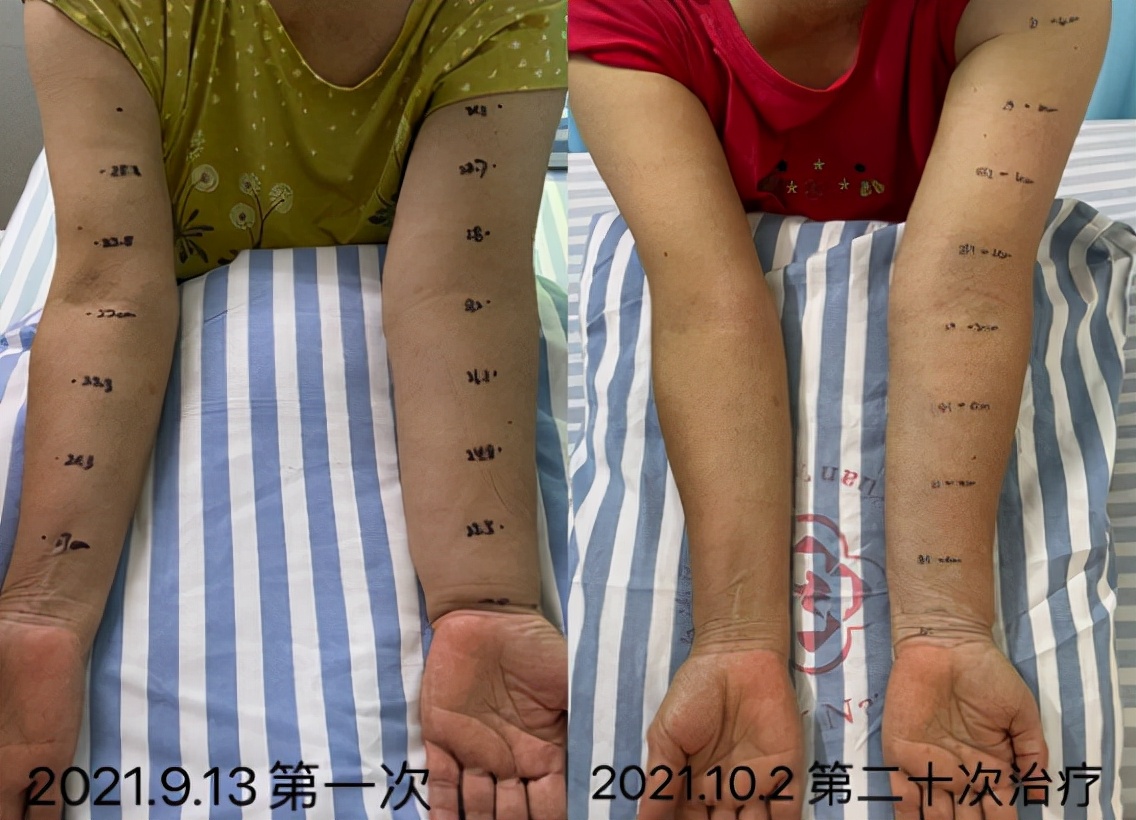 消肿最特效中草药药方,消肿中医特效药方