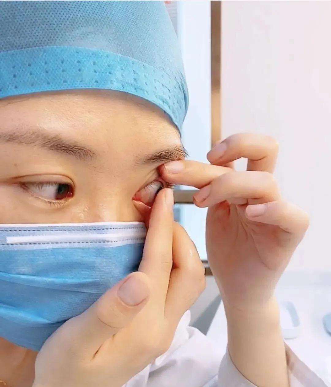 隐形眼镜怎么摘才不会伤害视网膜,隐形眼镜怎么摘都摘不下来怎么办