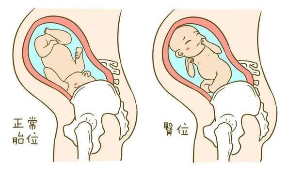 胎儿位置什么时候固定,胎儿在第几周的时候最不稳定