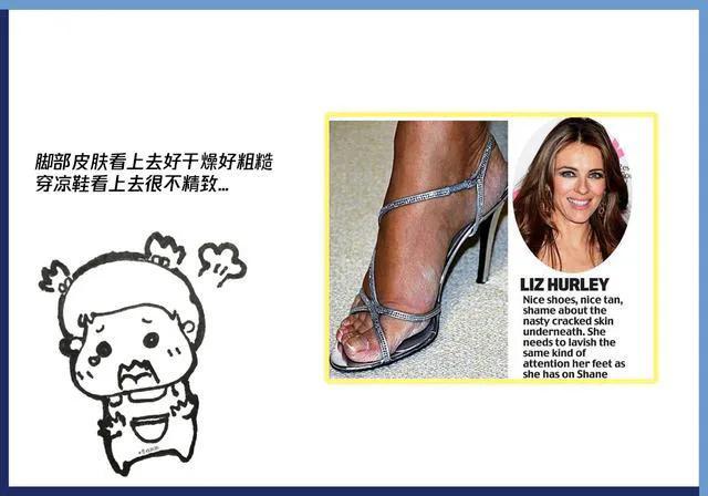 夏天总穿凉鞋皮肤粗糙,脚粗糙夏季如何穿凉鞋