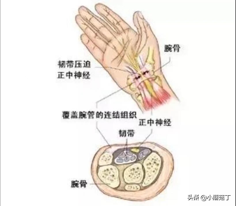 手腕酸疼痛一招自愈,手腕酸疼痛怎么缓解