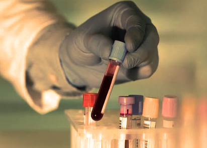 口腔反复溃疡出血,口腔出血警惕四种病