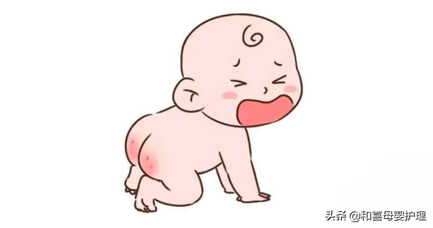 宝宝红屁股怎么办最有效的方法,解决宝宝红屁股的最快办法