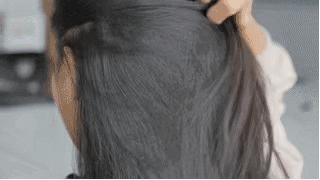 怎样去除头屑中的头皮屑,头皮屑多怎么办9个方法告别头屑