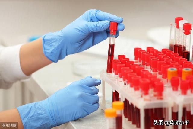 长白斑白发一定是白癜风吗,长白癜风注意什么