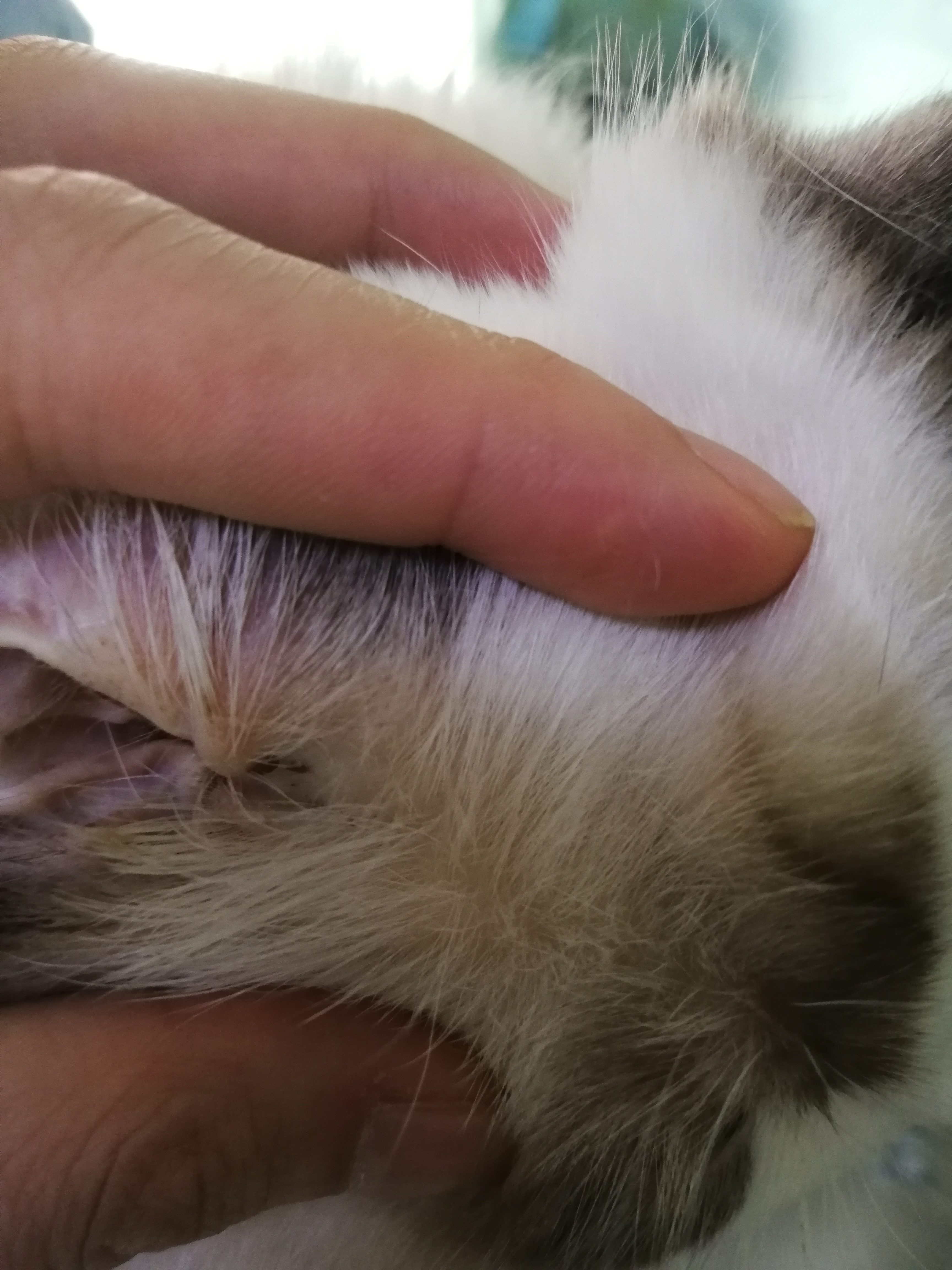 一招逆转脂肪肝,健康脂肪肝一个方子就解决