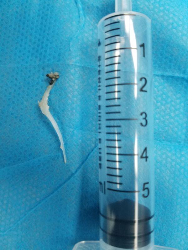 沈阳四院治耳鼻喉好吗,沈阳四院治耳鼻喉吗