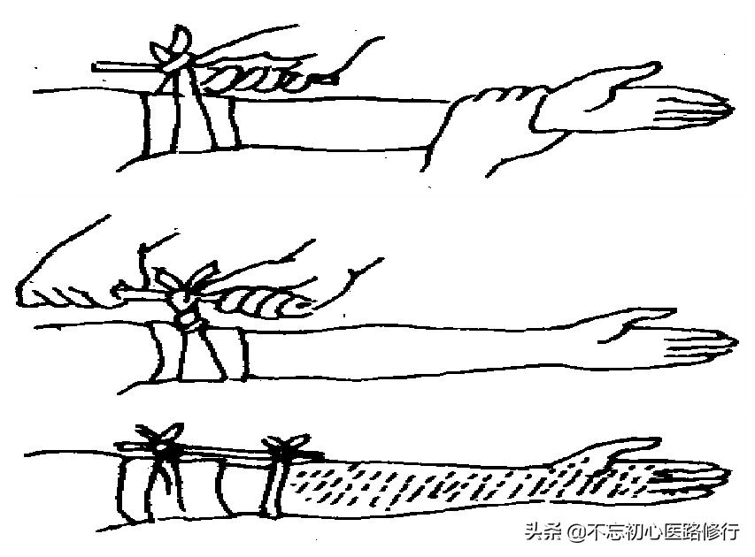 自救互救止血技术考核视频,紧急情况下如何止血自救互救