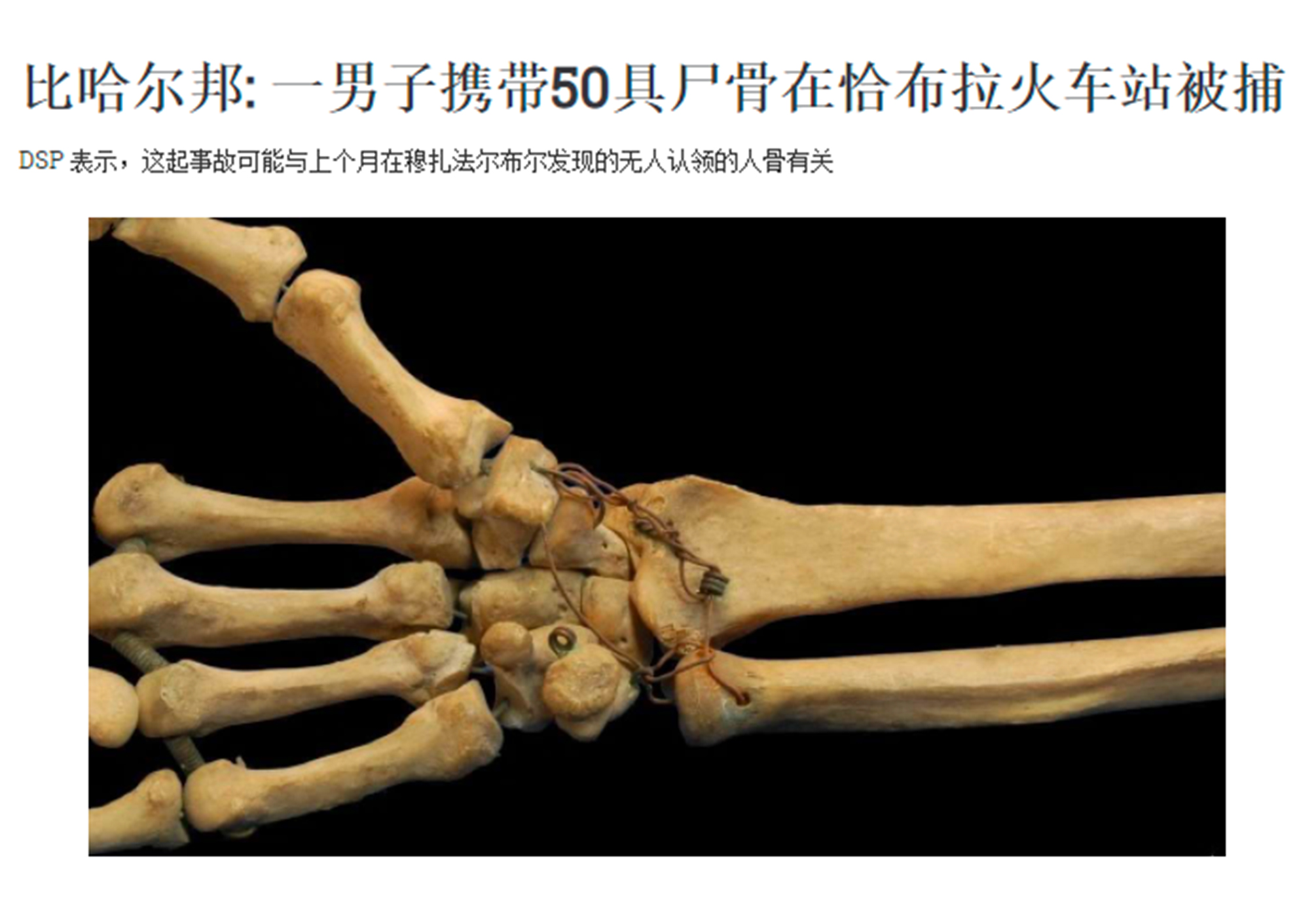 印度医院连死人都不放过电影,连死人都不放过印度电影