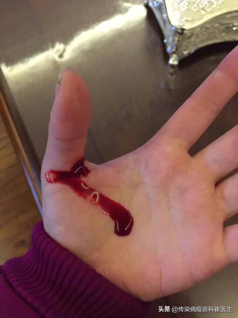 破伤风疫苗可以预防新冠吗,破伤风疫苗可以抵挡新冠吗