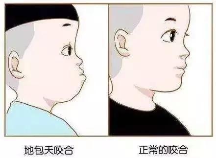 后槽牙的牙齿有点歪可以矫正吗,矫正牙齿过程中牙齿歪了正常吗