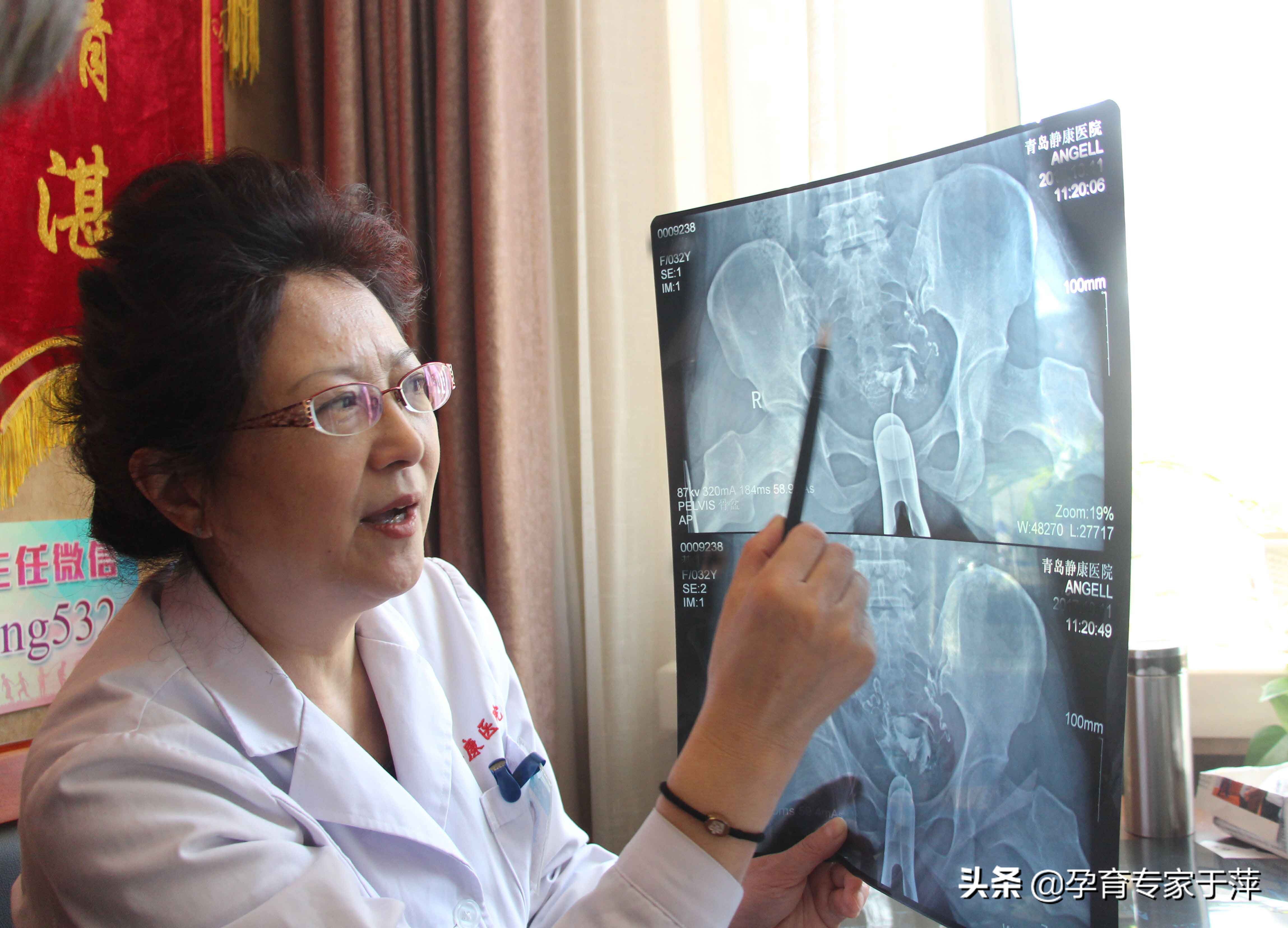 于萍主任青岛,青岛妇儿输卵管造影怎么样