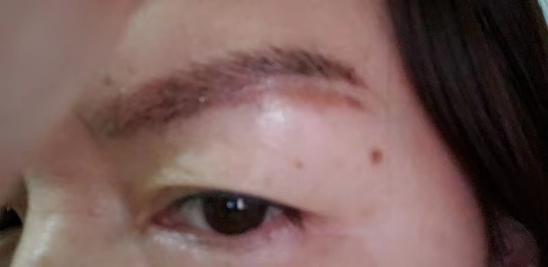 眉毛最常见的问题,关于眉毛的事情