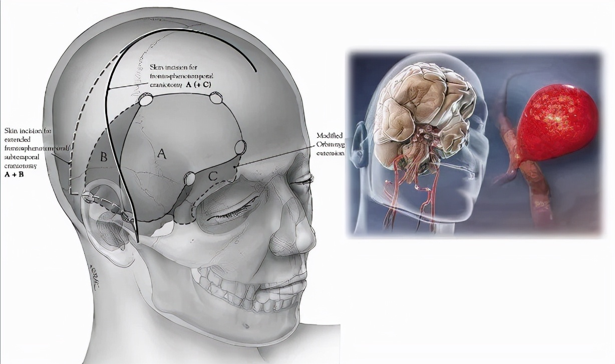 突然头疼要炸了怎么回事,睡觉突然头疼剧烈要炸了