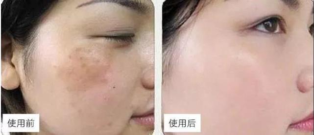 药店有一种“佑颜神药”,皮肤越擦越白嫩,关键不贵,遇到别错过