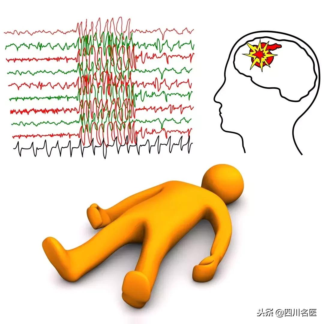 吃饭总咬舌头是什么病的前兆,老咬舌头出现这个问题不要轻视