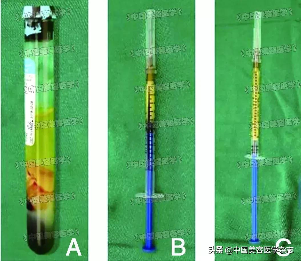 纳米脂肪填充和prp有啥区别,脂肪填充和prp