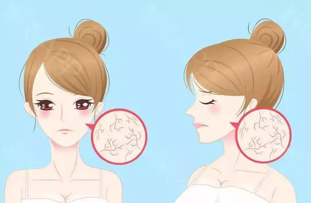 春季脸上干燥泛红发痒起皮怎么办,脸上干燥起皮泛红用什么补水