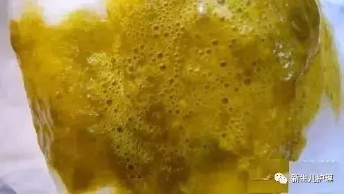 新手爸妈｜奶瓣、绿便、腹泻、便秘……宝宝各种便便真图全解必备