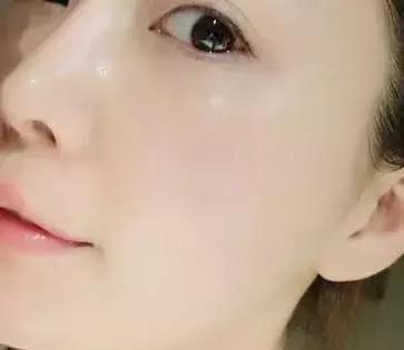 护肤反而皮肤差,改掉这些护肤恶习让你越变越美丽