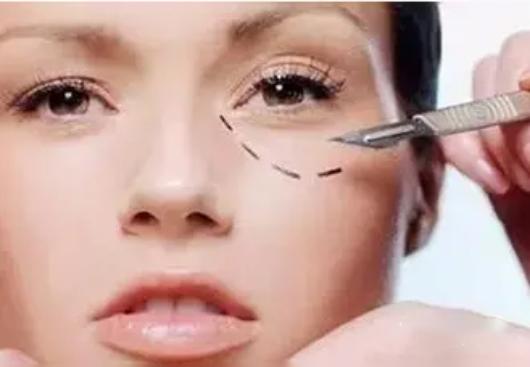 祛眼袋推荐什么方法,祛眼袋什么方法最靠谱