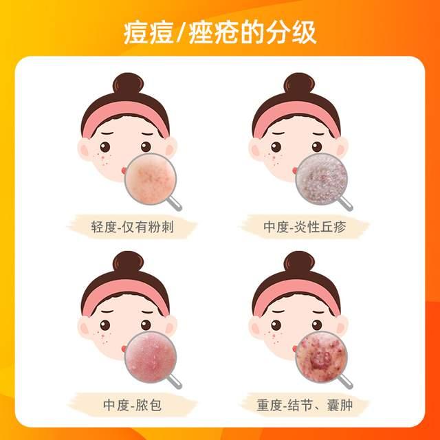 疮痈用药大全,医院治疗痤疮常用的处方药