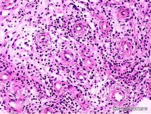 打球崴脚急救措施,打球崴脚了怎么高情商安慰