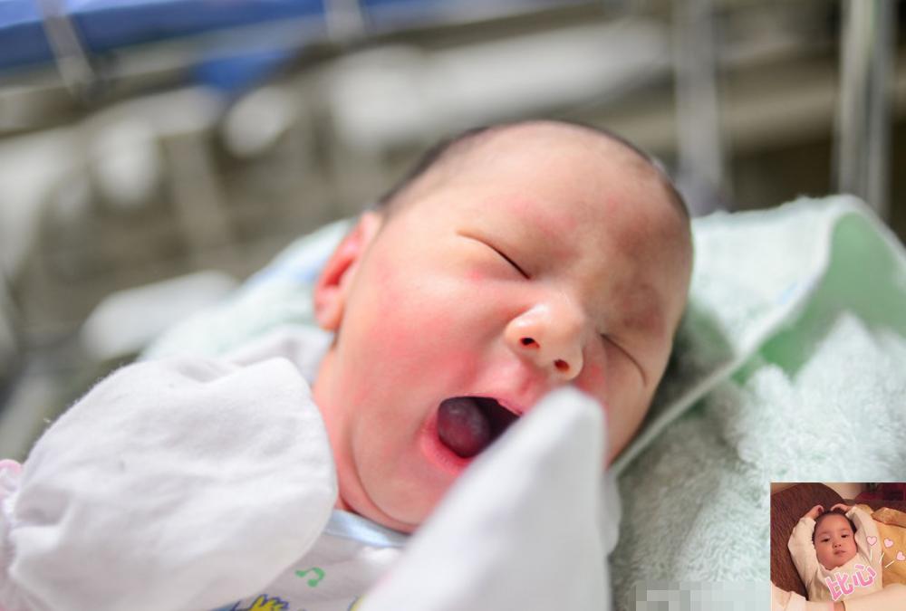 顺产弊端,顺产的十大弊端