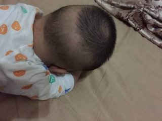 儿童脑袋中间凹下去是什么原因,小孩头顶凹下去一块是怎么回事