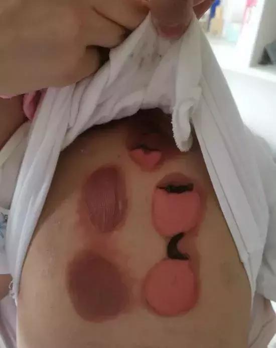 健康小常识小心烫伤,健康常识骗了多少人