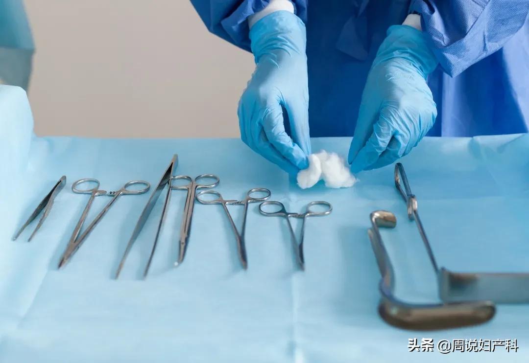 为什么妇科医生会问有无流产史,人流医生会问过往人流史吗