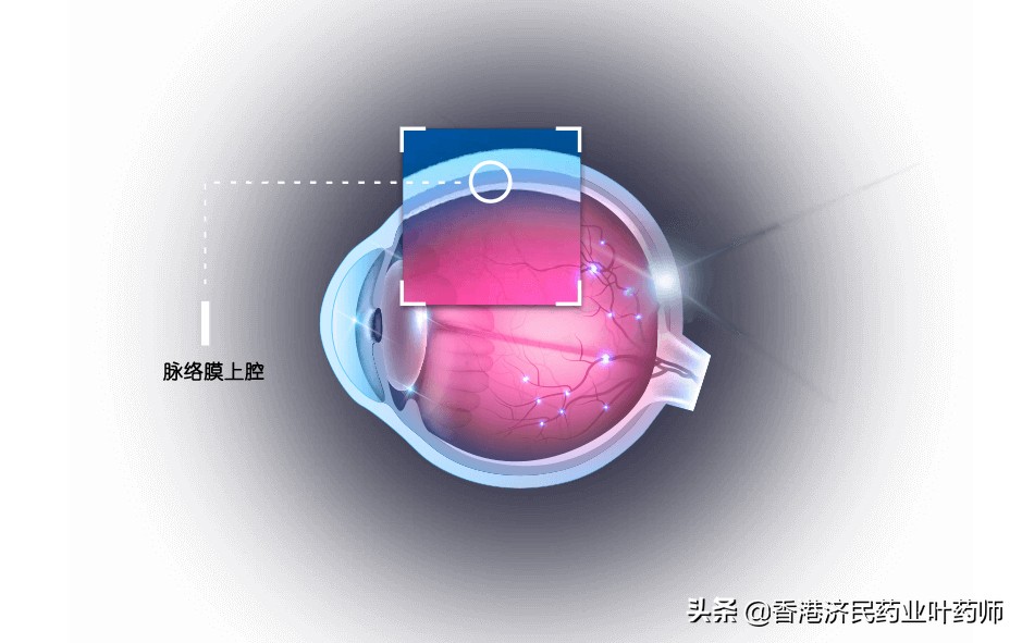 治疗葡萄膜炎的生物制剂有什么,葡萄膜炎专用药