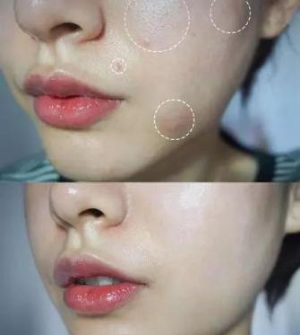 火山泥真是宝,油皮女孩的毛孔疏通剂,让贵妇霜3秒吃透锁水8倍