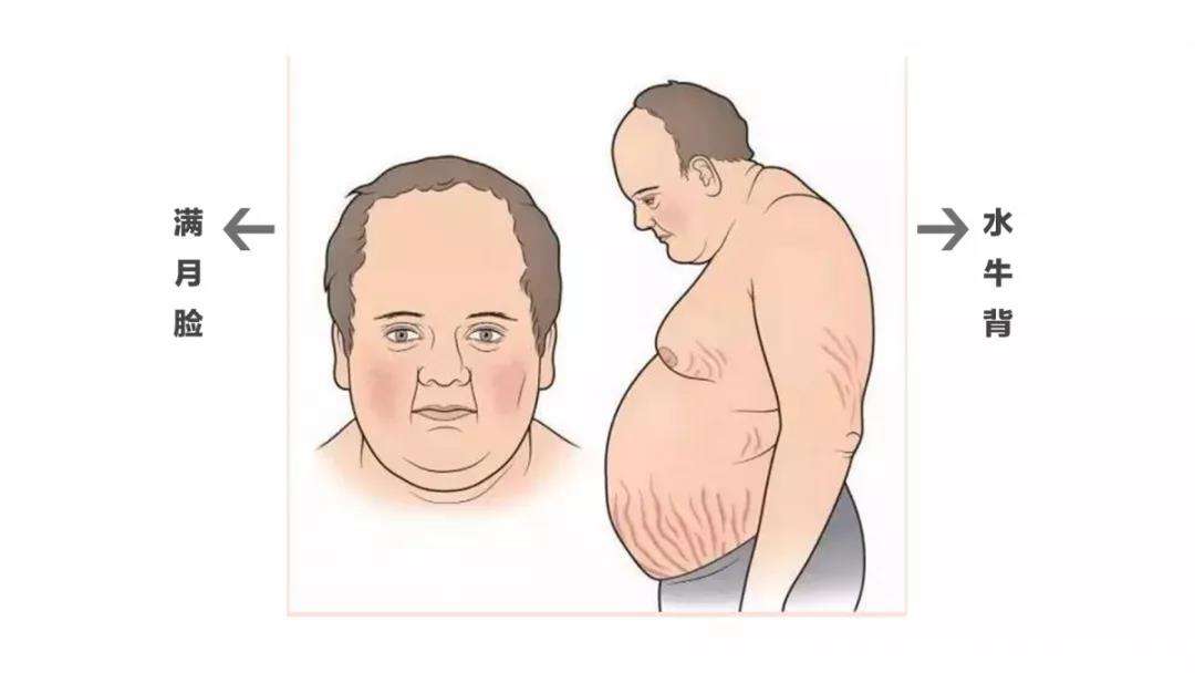 长期外用激素药会影响宝宝吗,长期服用激素会影响孩子长高吗