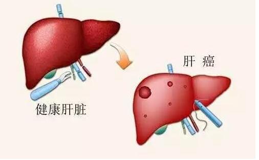 两对半145严重吗,两对半145阳性是什么