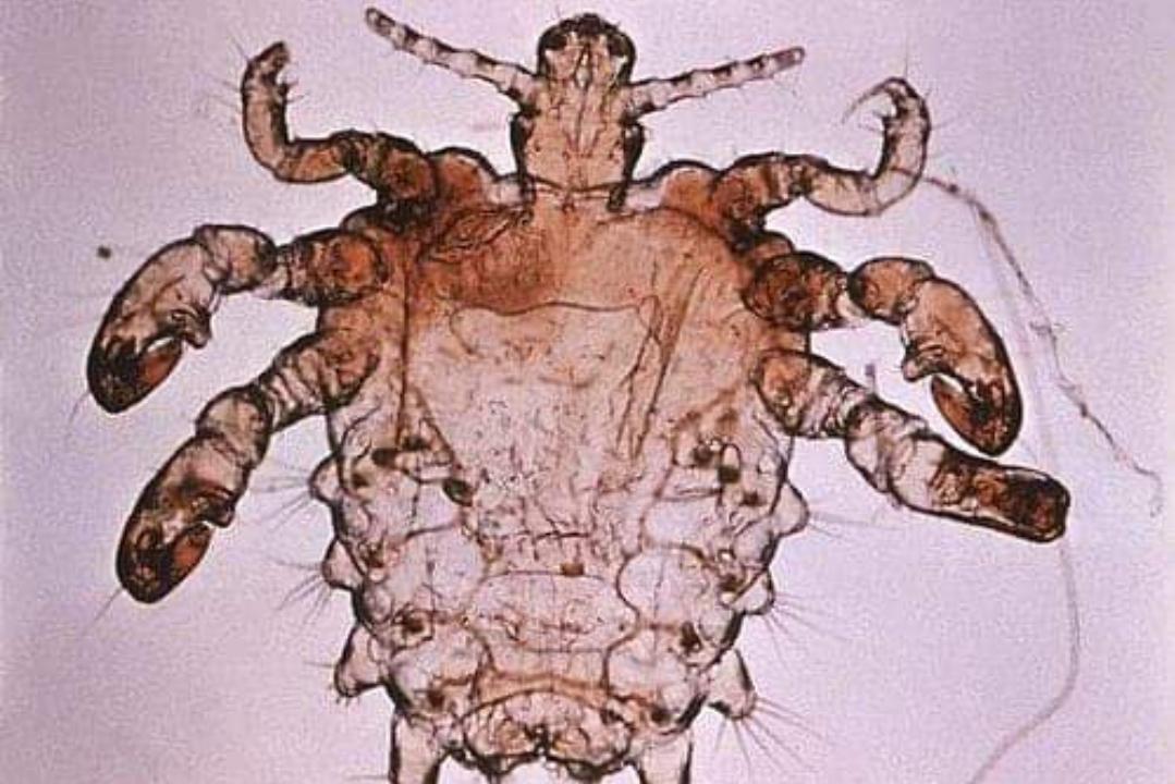 虱子和阴虱样子一样吗,阴虱头虱体虱能用一样的药吗