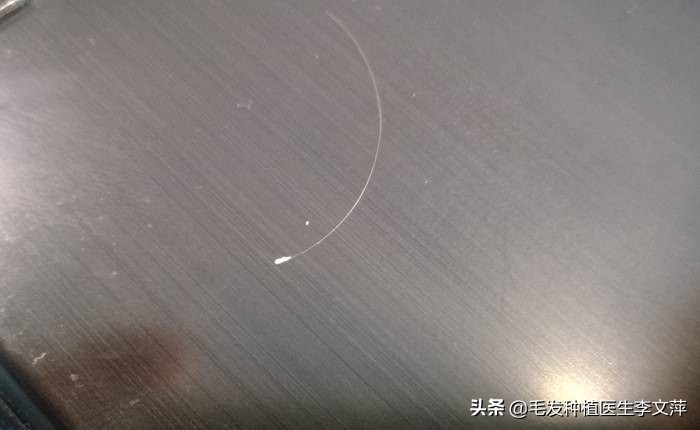 连根掉的毛囊毛还会再长出来吗,梳头掉下的头发有小白点是毛囊吗