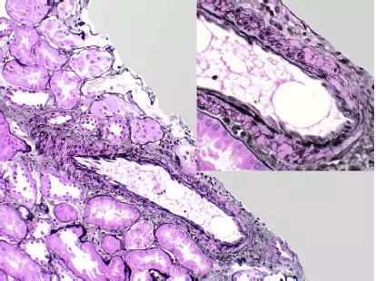 肾毒性食物一览表,肾毒性的药物排名