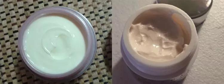 脂肪粒别用针挑教你一个土办法,脂肪粒怎么用针挑出来不疼