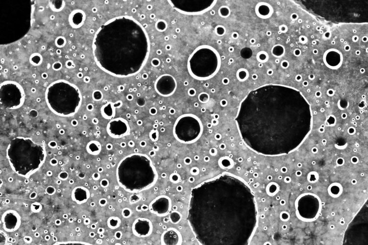 少年白发吃什么中药治白头发,两鬓长白发的原因及治疗方法