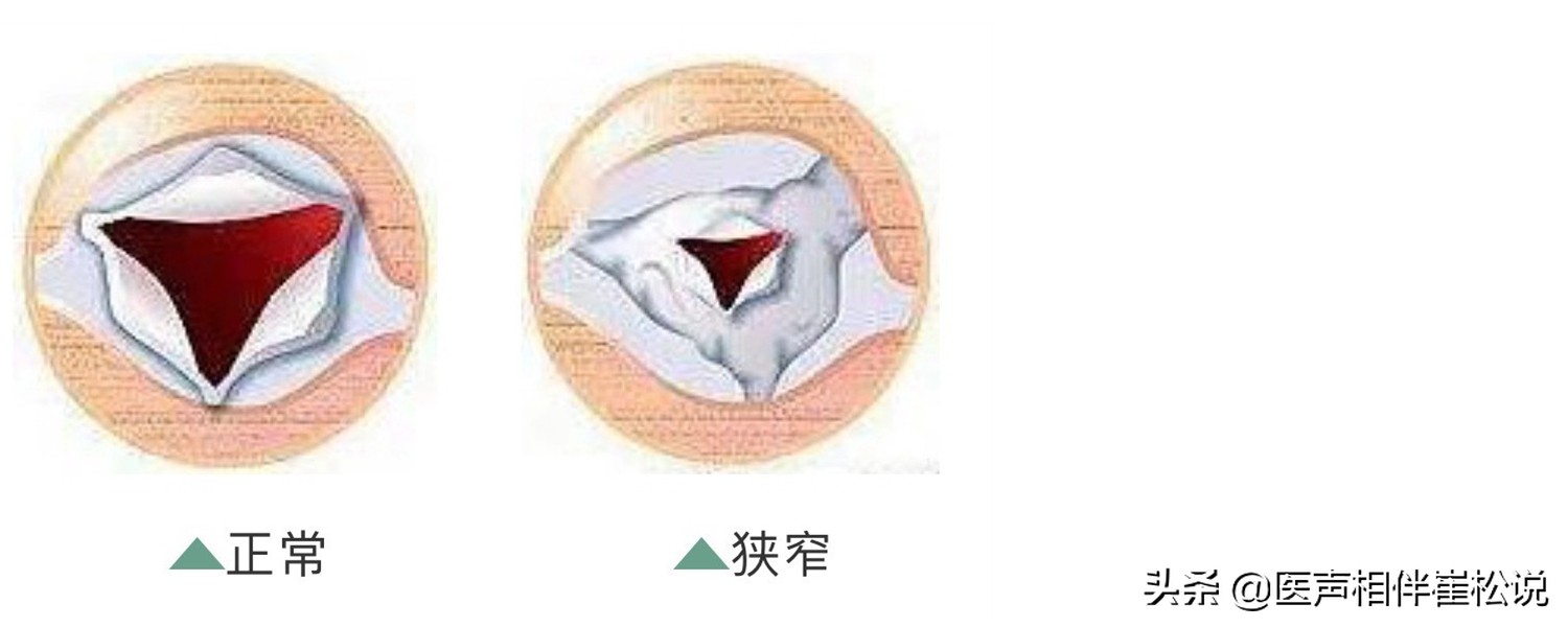 这份心脏说明书请收好,心脏保健手册