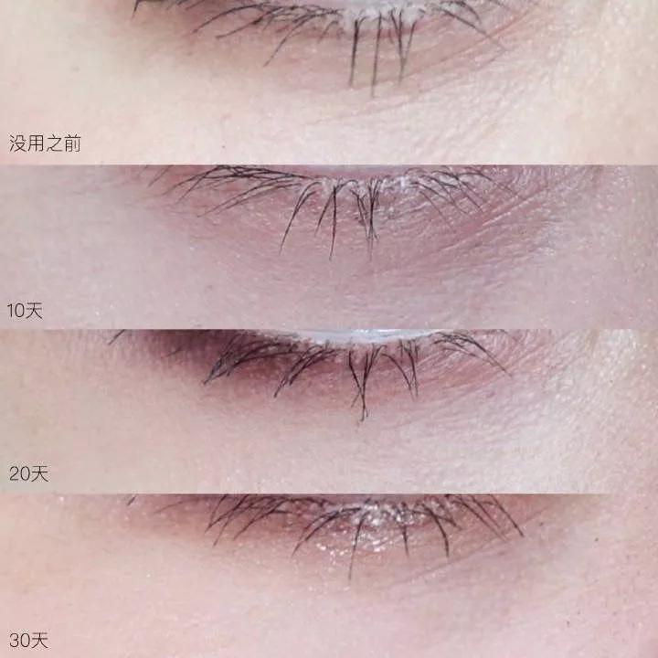 雅诗兰黛日本产的眼霜,用了雅诗兰黛皱纹更明显了